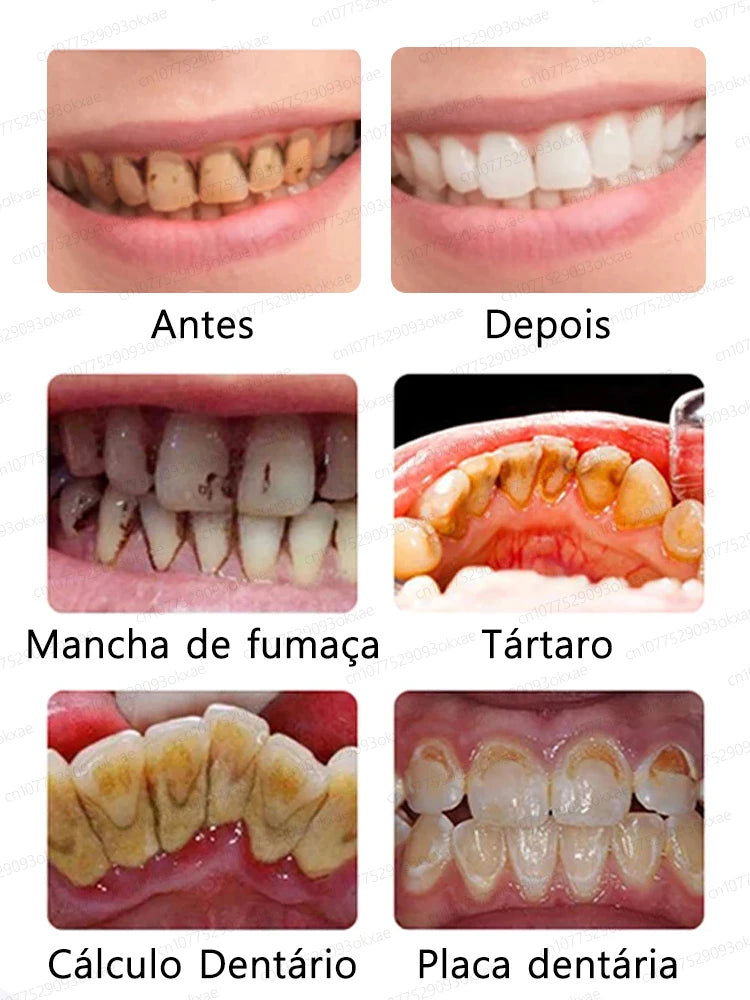 Creme dental Mousse V34 - COMPRE 2 LEVE 3 - ULTIMAS UNIDADES