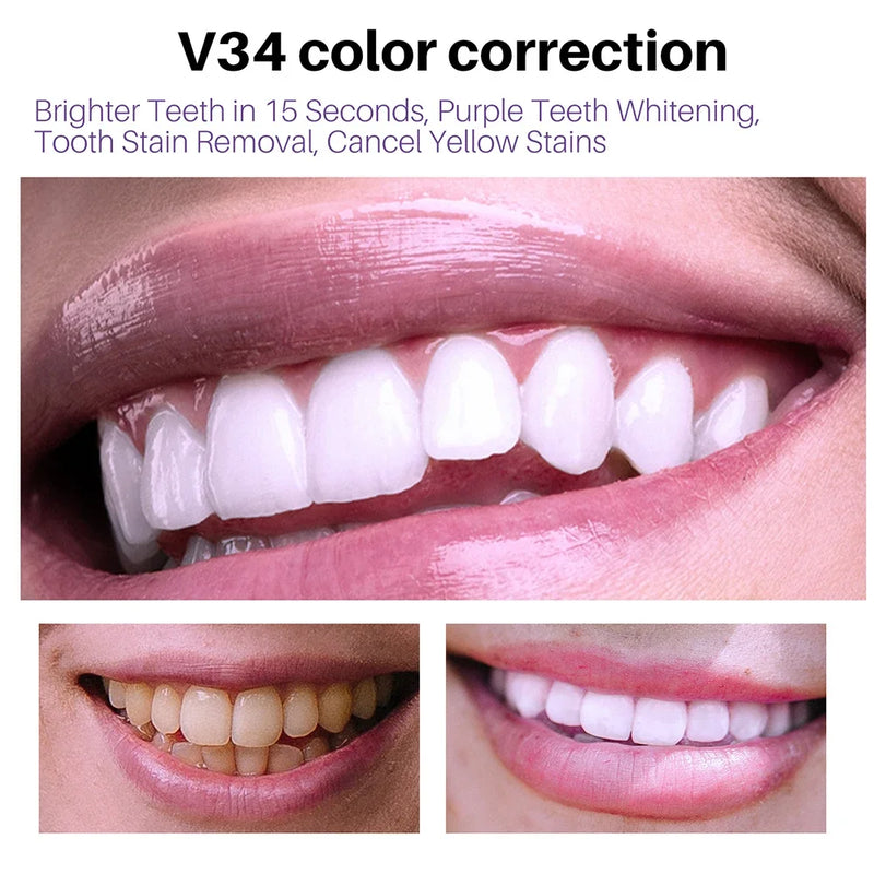 Creme dental Mousse V34 - COMPRE 2 LEVE 3 - ULTIMAS UNIDADES